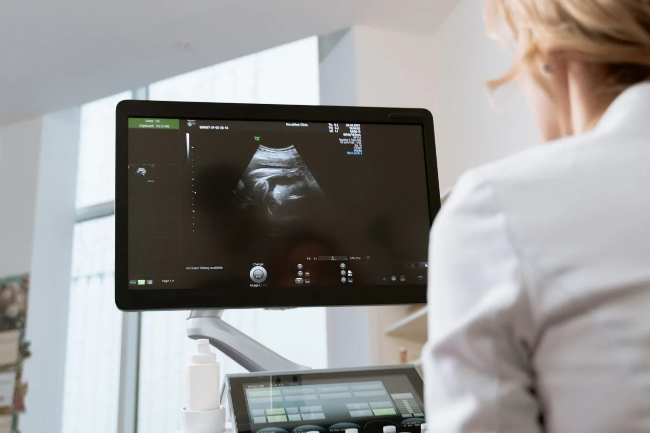 Muga Scan