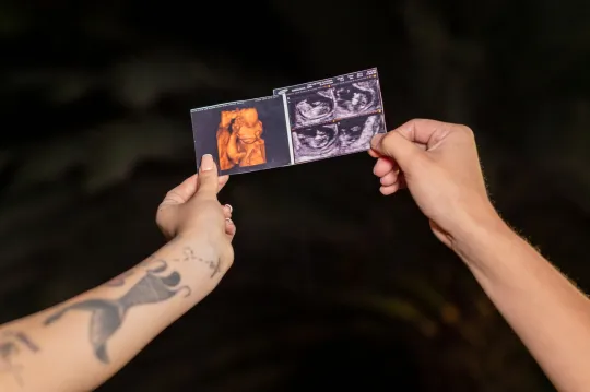 Nst Fetal: What to Expect, Week by Week