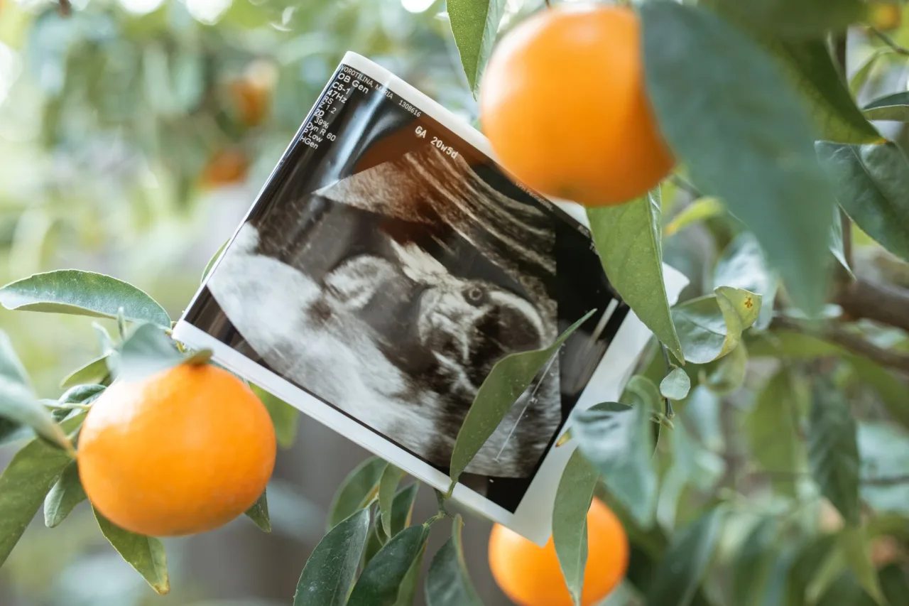 Sonography Machine Price: Real Prices