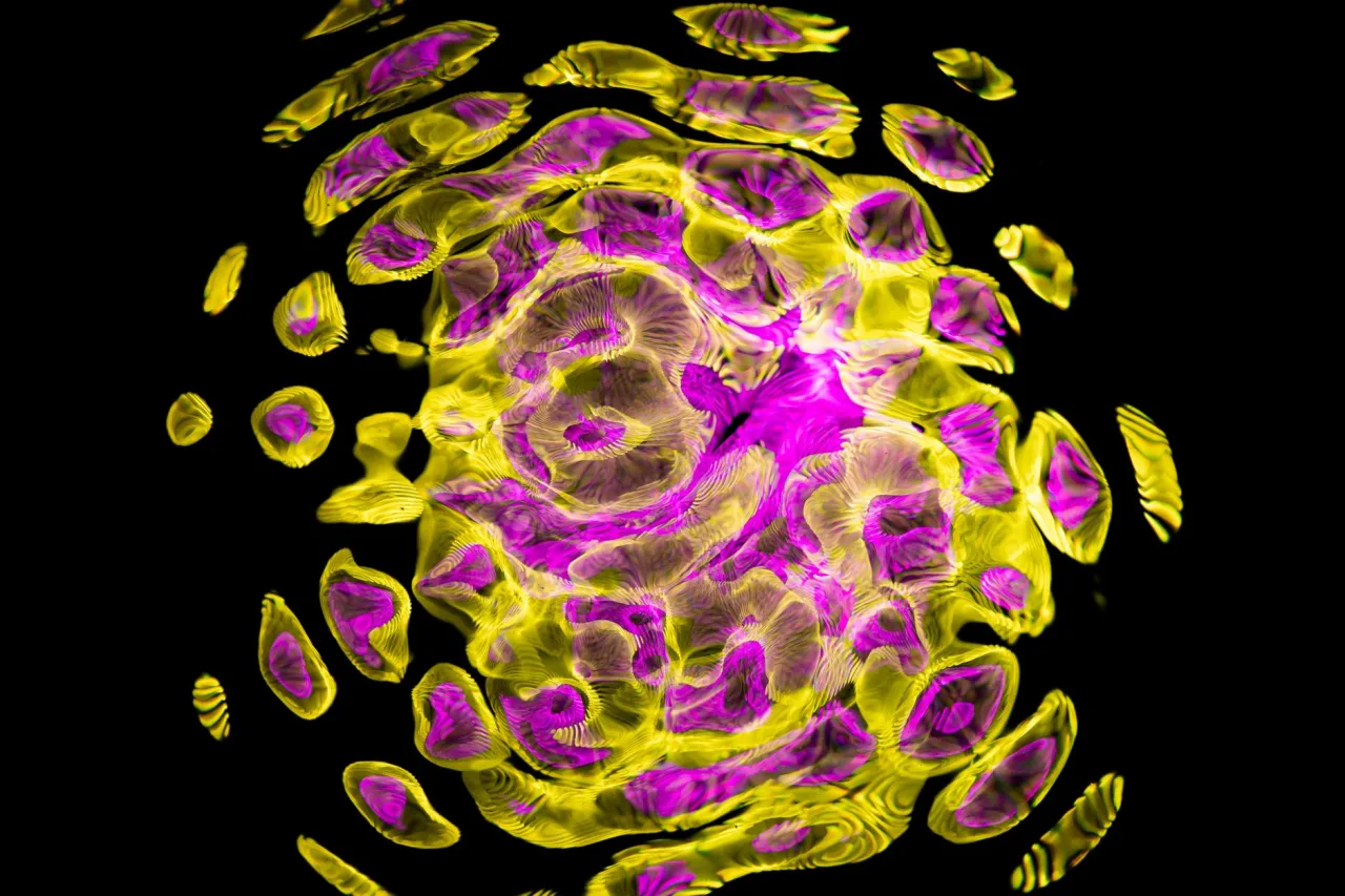 Susceptibility Weighted Imaging