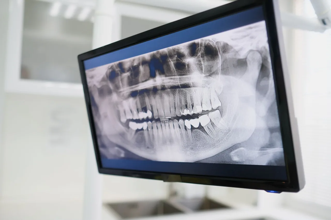 TGH Imaging: What It Is and Uses