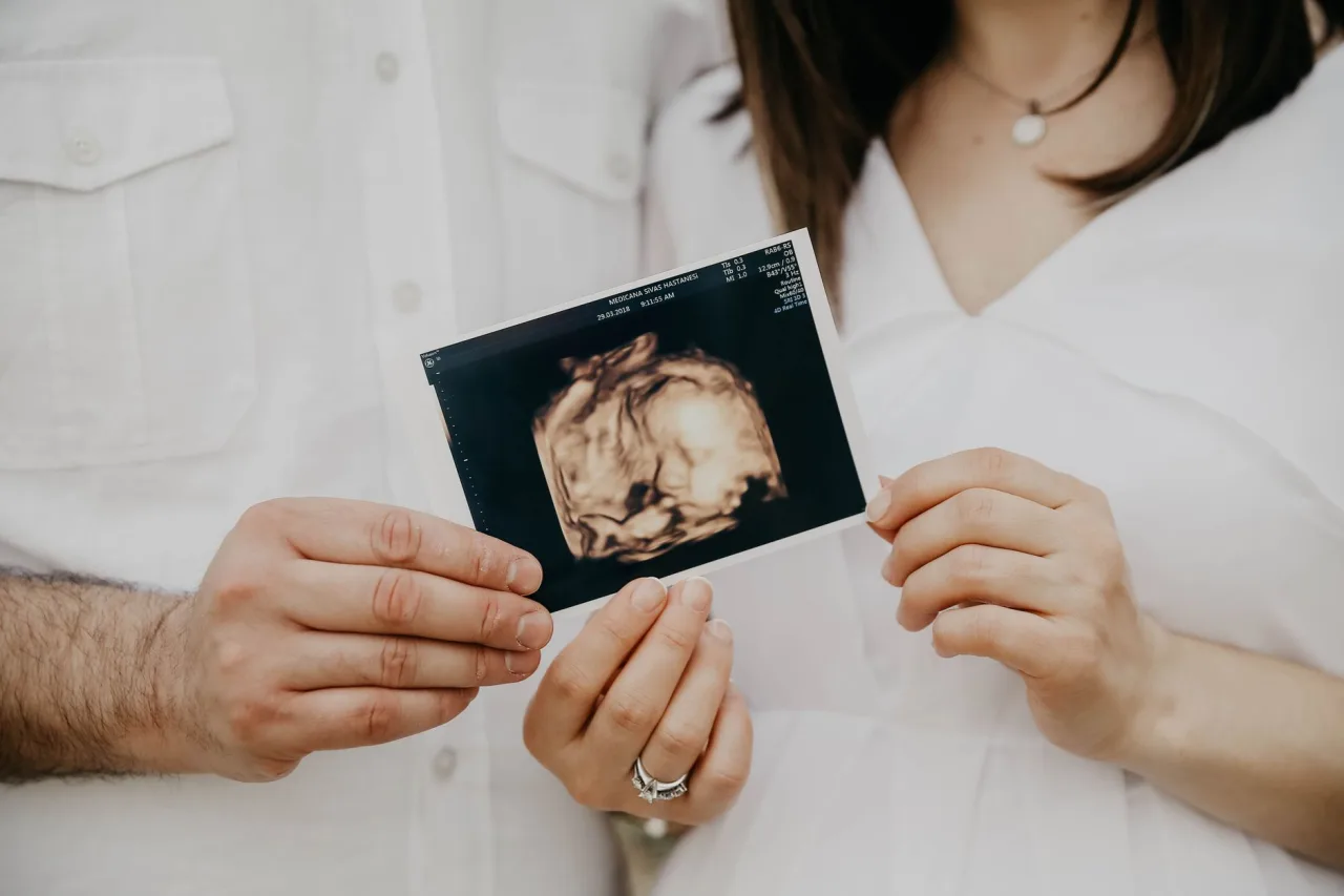 Ultrasound in Pregnancy Guide