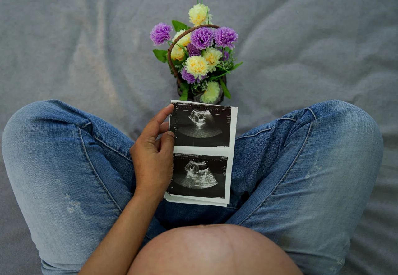 Ultrasound in Pregnancy Guide