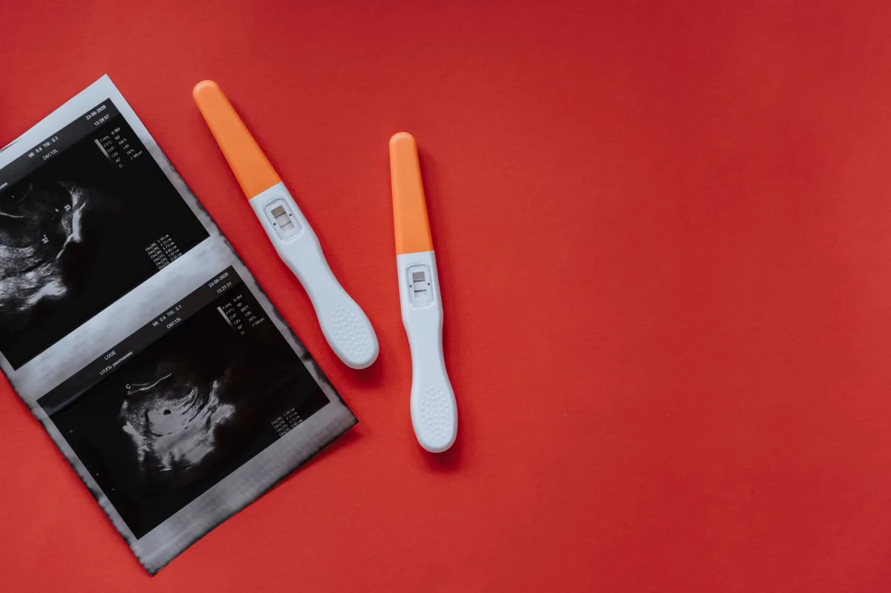 Ultrasound Locations Near Me