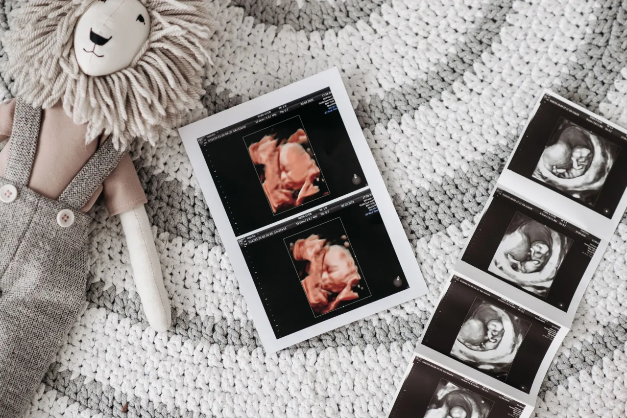 Ultrasound Near Me: How to Choose