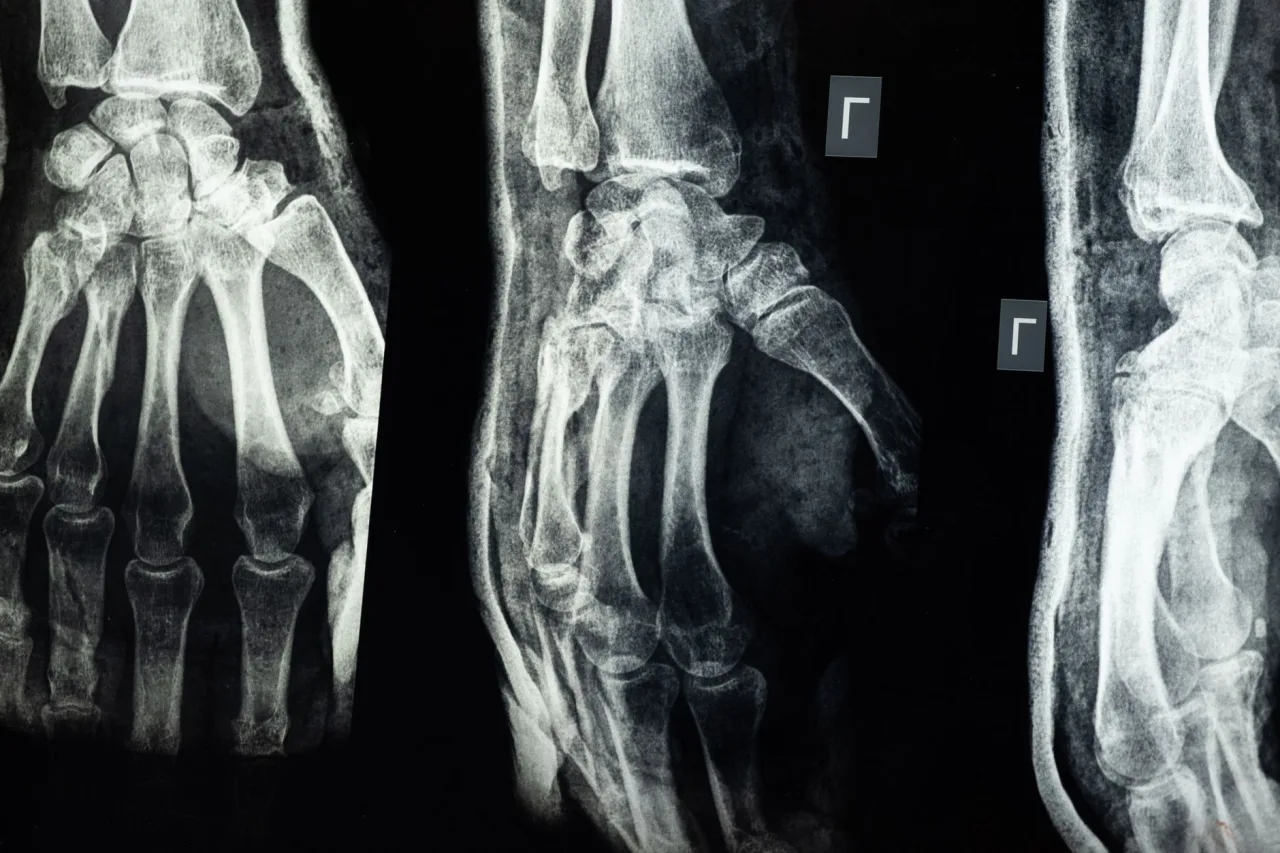 X-Ray Imaging